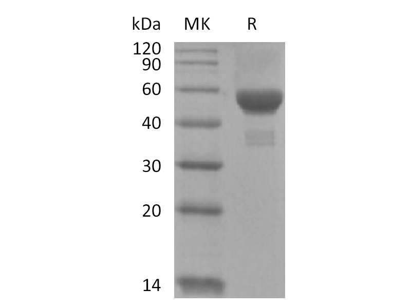 重组人Carbonic Anhydrase 9 (C-6His)蛋白 | EnkiLife恩玑生命