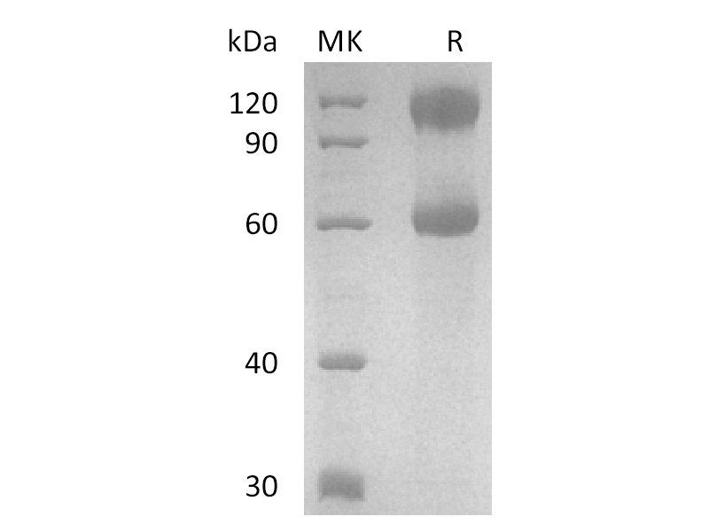 重组人IL-2 R beta&IL-2 R alpha&IL-2 R gamma? Heterotrimer Protein (C-Fc)蛋白 | EnkiLife恩玑生命