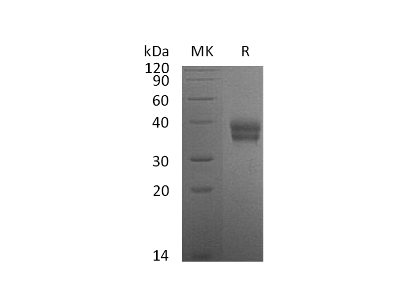 重组小鼠Carbonic Anhydrase 12 (C-6His)蛋白 | EnkiLife恩玑生命