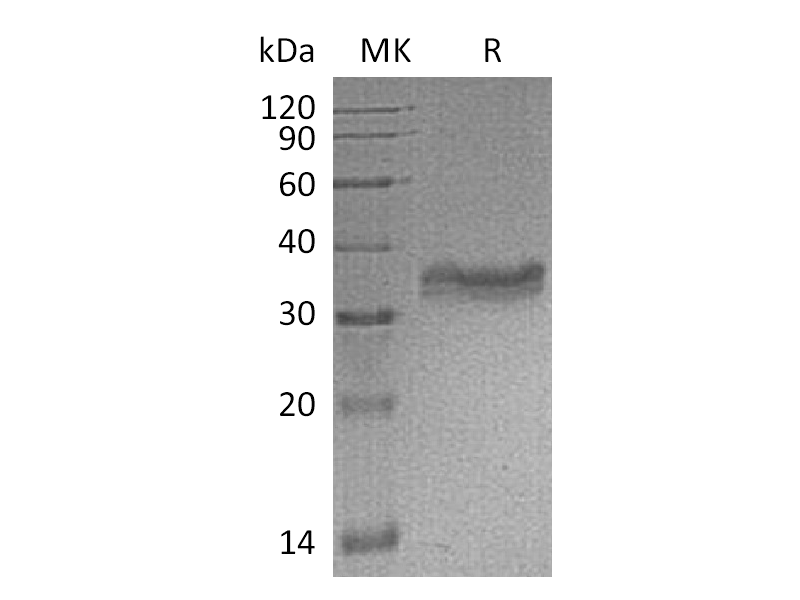 重组小鼠Carbonic Anhydrase 4 (C-6His)蛋白 | EnkiLife恩玑生命