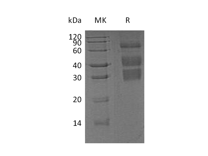重组小鼠Clusterin (C-6His)蛋白 | EnkiLife恩玑生命