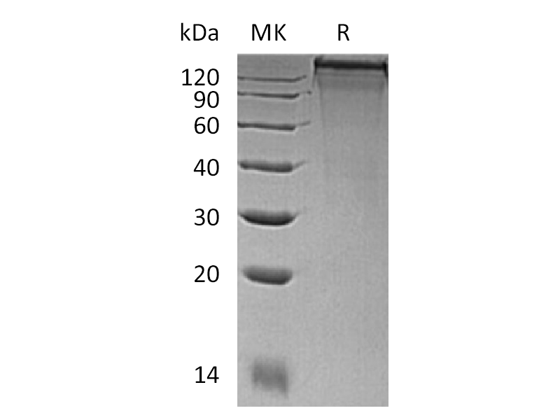 重组小鼠COL3A1 (C-6His)蛋白 | EnkiLife恩玑生命