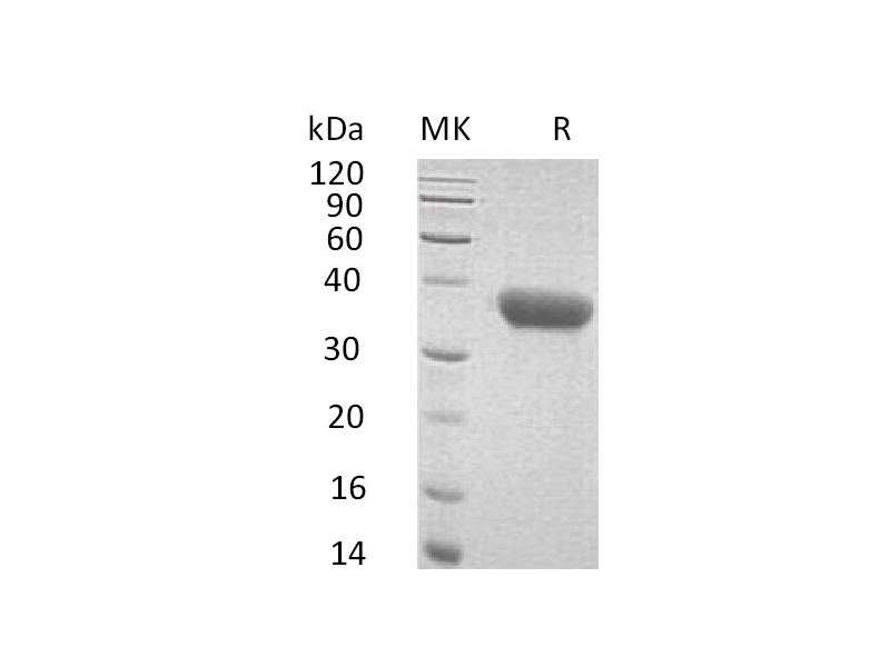 重组小鼠CXCL16 (C-6His)蛋白 | EnkiLife恩玑生命