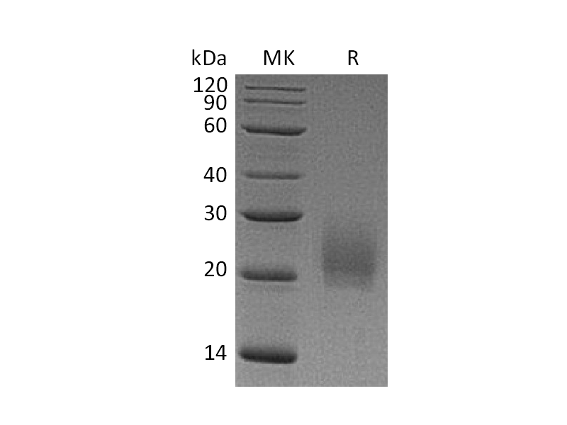 重组小鼠CTLA-4 (C-6His)蛋白 | EnkiLife恩玑生命