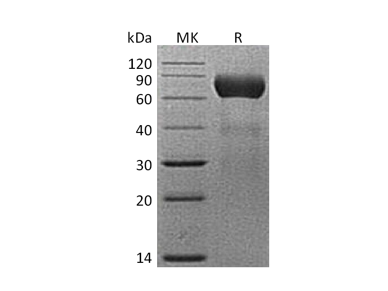 重组小鼠CD39L1 (C-6His)蛋白 | EnkiLife恩玑生命