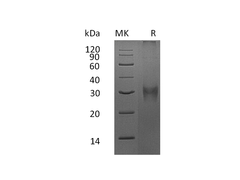 重组小鼠Asprosin (N-8His)蛋白 | EnkiLife恩玑生命