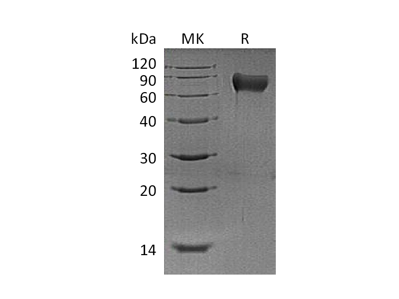 重组小鼠Hemopexin (C-6His)蛋白 | EnkiLife恩玑生命