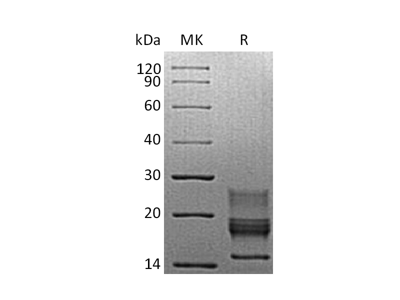 重组小鼠IFN gamma (C-6His)蛋白 | EnkiLife恩玑生命