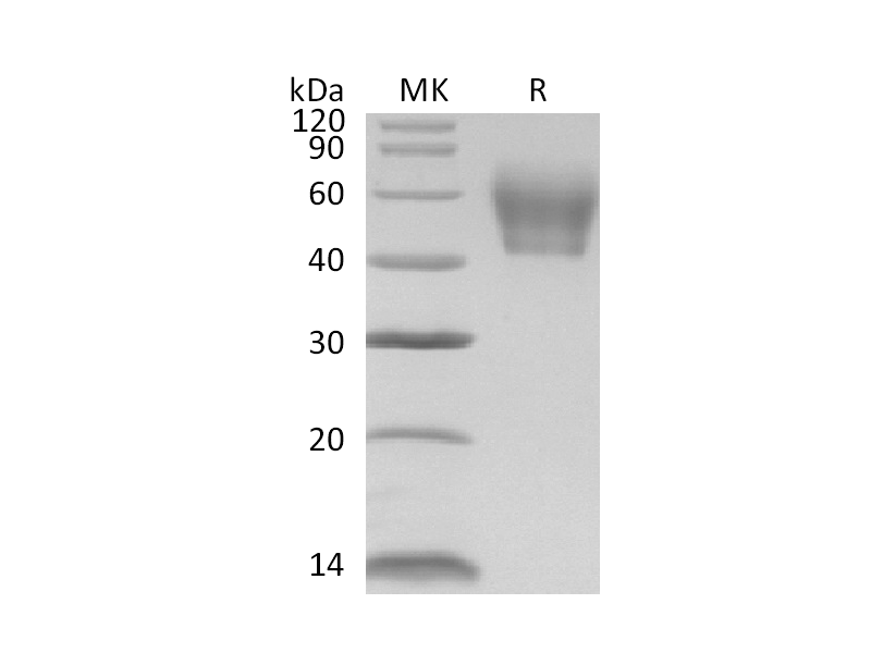 重组小鼠IL-1R2 (C-6His)蛋白 | EnkiLife恩玑生命