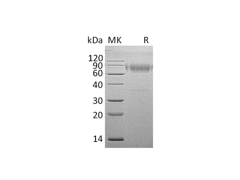 重组小鼠IL-18BPd (C-Fc)蛋白 | EnkiLife恩玑生命