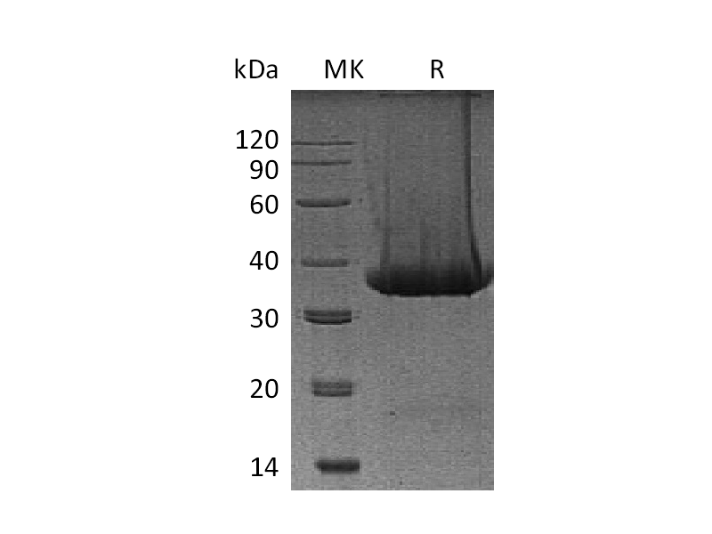 重组小鼠Kallikrein 1 (C-6His)蛋白 | EnkiLife恩玑生命