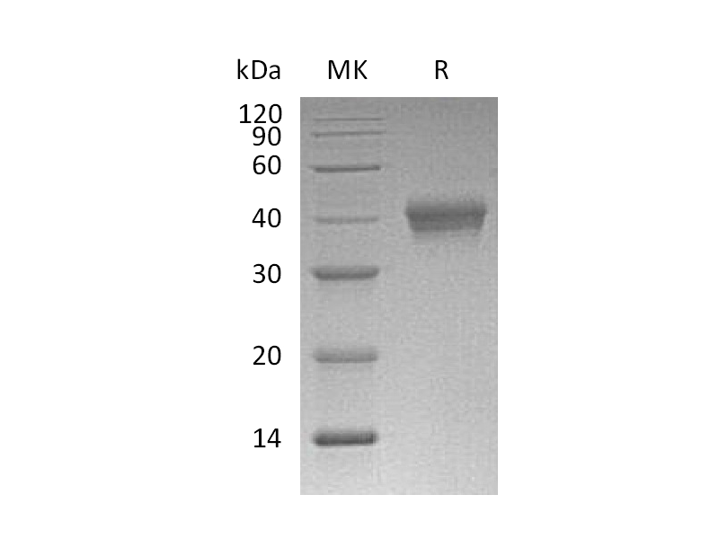 重组小鼠CD38 (C-6His)蛋白 | EnkiLife恩玑生命