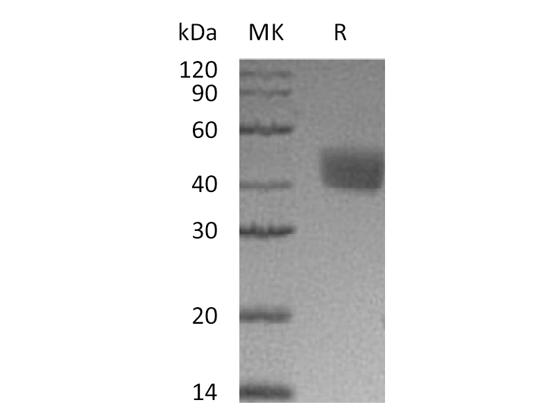重组小鼠Mesothelin (C-6His)蛋白 | EnkiLife恩玑生命