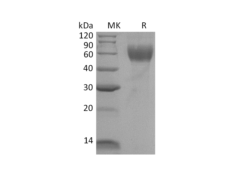 重组小鼠IL-1R1 (C-6His)蛋白 | EnkiLife恩玑生命