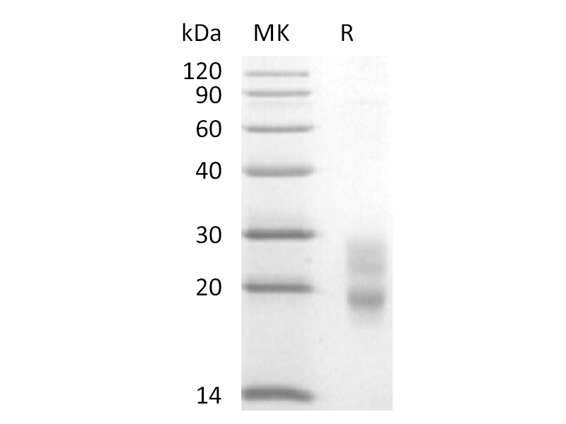 重组小鼠CD7 (C-6His)蛋白 | EnkiLife恩玑生命