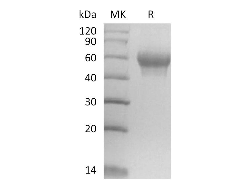 重组小鼠IL-6RA (C-6His)蛋白 | EnkiLife恩玑生命