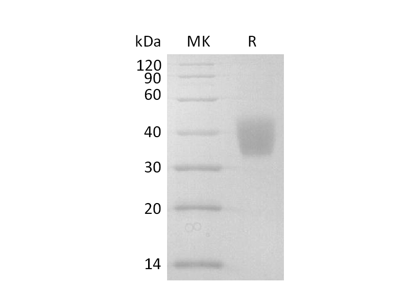 重组小鼠IL-4RA (C-6His)蛋白 | EnkiLife恩玑生命