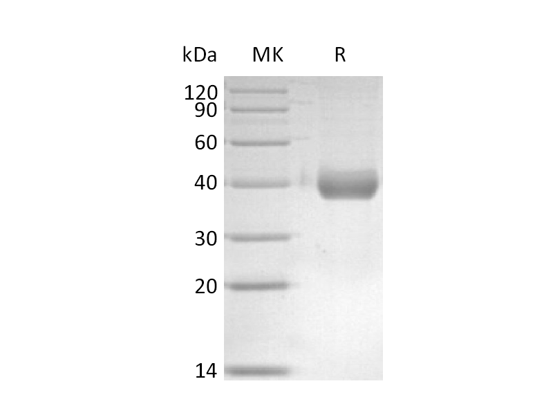 重组小鼠IL-17RB (C-6His)蛋白 | EnkiLife恩玑生命