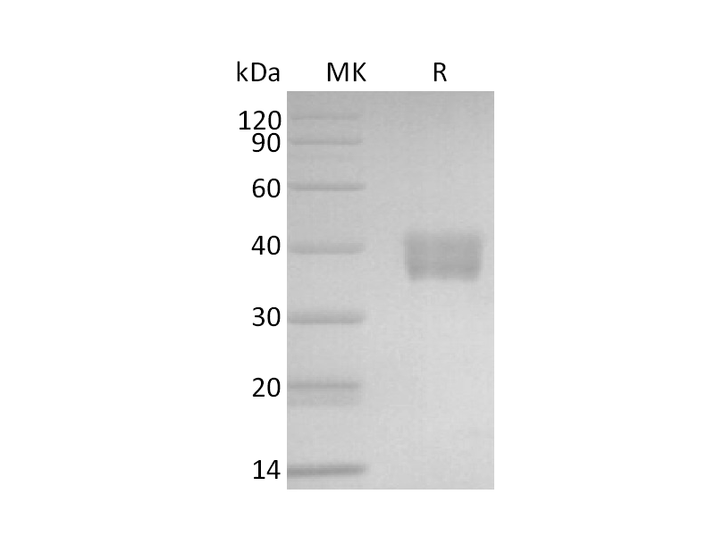 重组小鼠IL-17RE (C-6His)蛋白 | EnkiLife恩玑生命