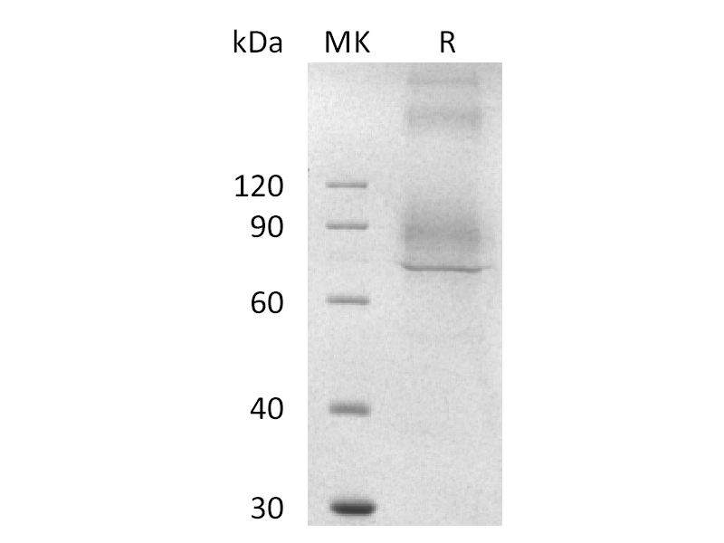 重组小鼠NaPi2b (C-Flag)蛋白 | EnkiLife恩玑生命
