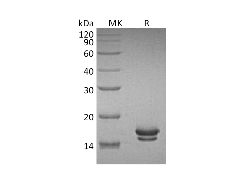 重组大鼠IL-2 (C-6His)蛋白 | EnkiLife恩玑生命