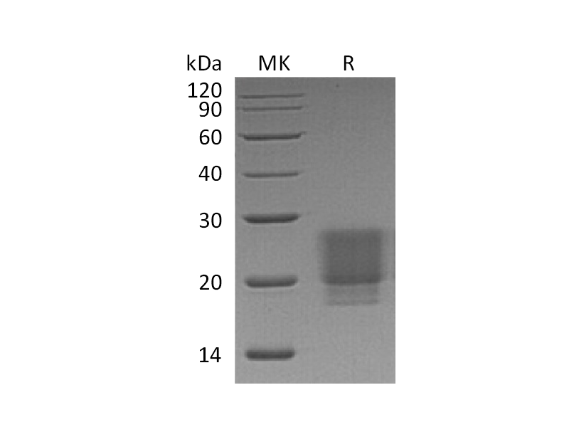 重组人/小鼠/大鼠Irisin (C-6His)蛋白 | EnkiLife恩玑生命
