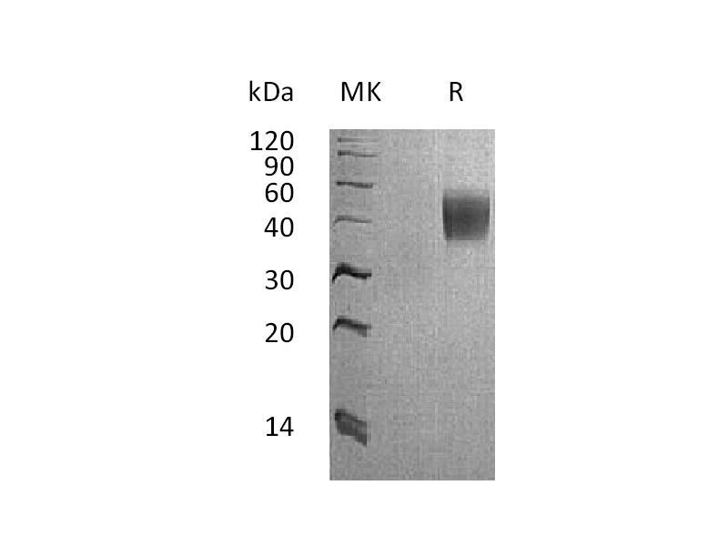 重组食蟹猴IL-4RA (C-6His)蛋白 | EnkiLife恩玑生命