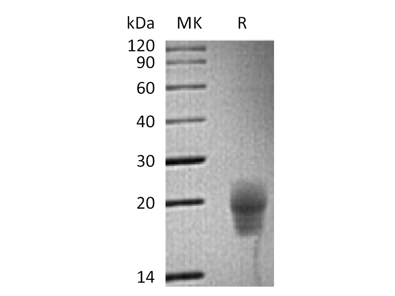 重组食蟹猴CTLA-4 (C-6His)蛋白 | EnkiLife恩玑生命