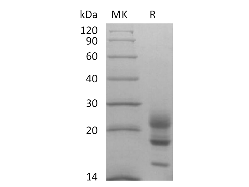 重组食蟹猴IL-17A (C-6His)蛋白 | EnkiLife恩玑生命