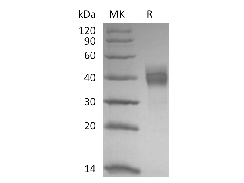重组猕猴TROP-2 (C-6His)蛋白 | EnkiLife恩玑生命