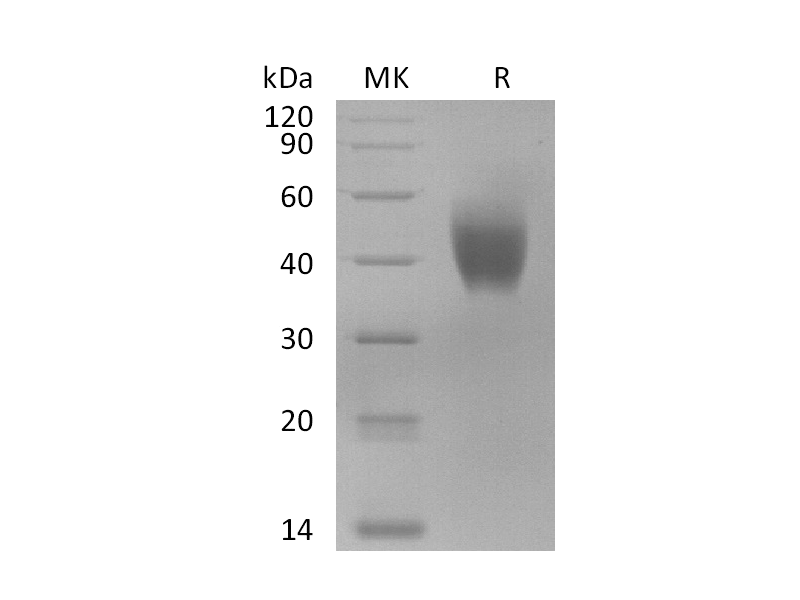 重组猕猴IL-10RA (C-6His)蛋白 | EnkiLife恩玑生命