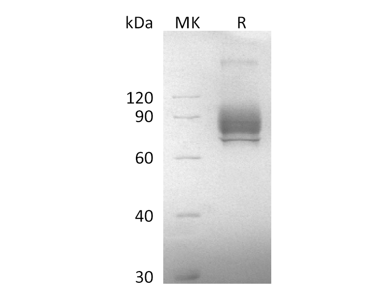 重组食蟹猴NaPi2b (C-Flag)蛋白 | EnkiLife恩玑生命