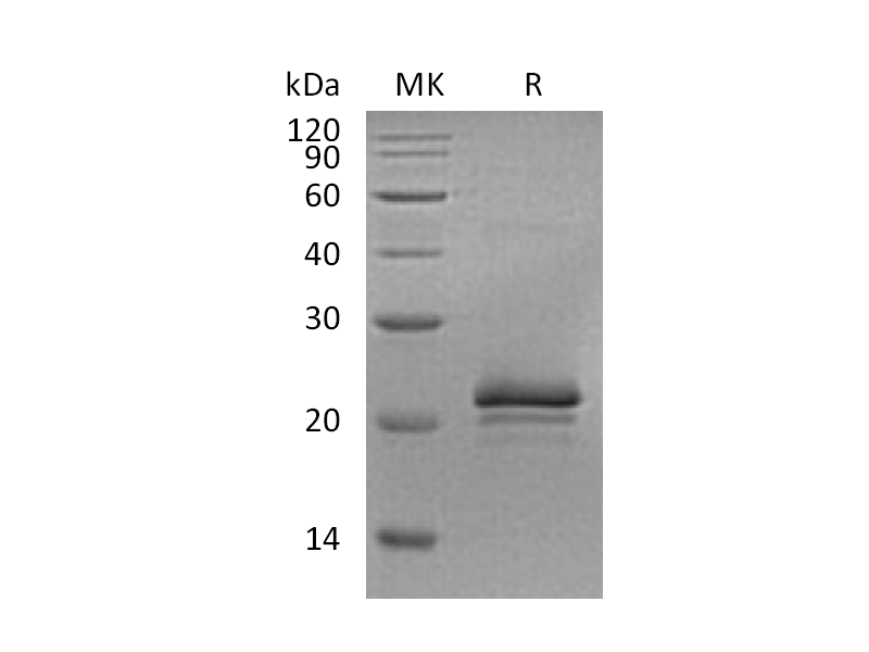 重组大鼠VEGF 164蛋白 | EnkiLife恩玑生命