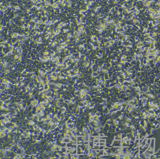 LOVO+LUC（人结直肠癌细胞荧光素酶标记）YB-71876HC-L