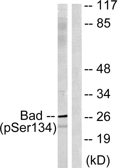 Bad (phospho Ser134) Rabbit Polyclonal Antibody | 兔多抗 | EnkiLife恩玑生命