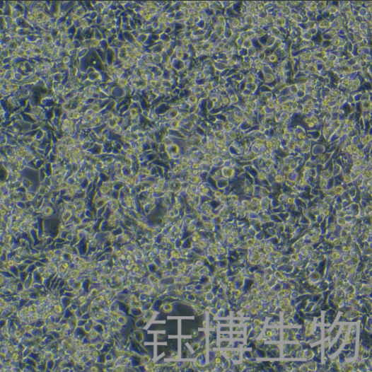 MyC-CaP（小鼠前列腺癌细胞）YB-7056MC