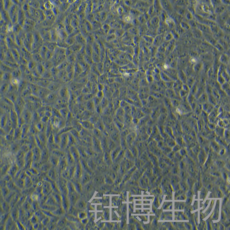 Mahlavu（人肝癌细胞）YB-71877HC