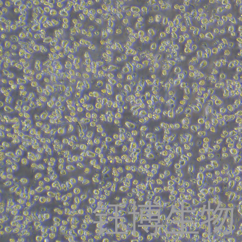 LUVA（人肥大细胞系永生化）YB-71882HC