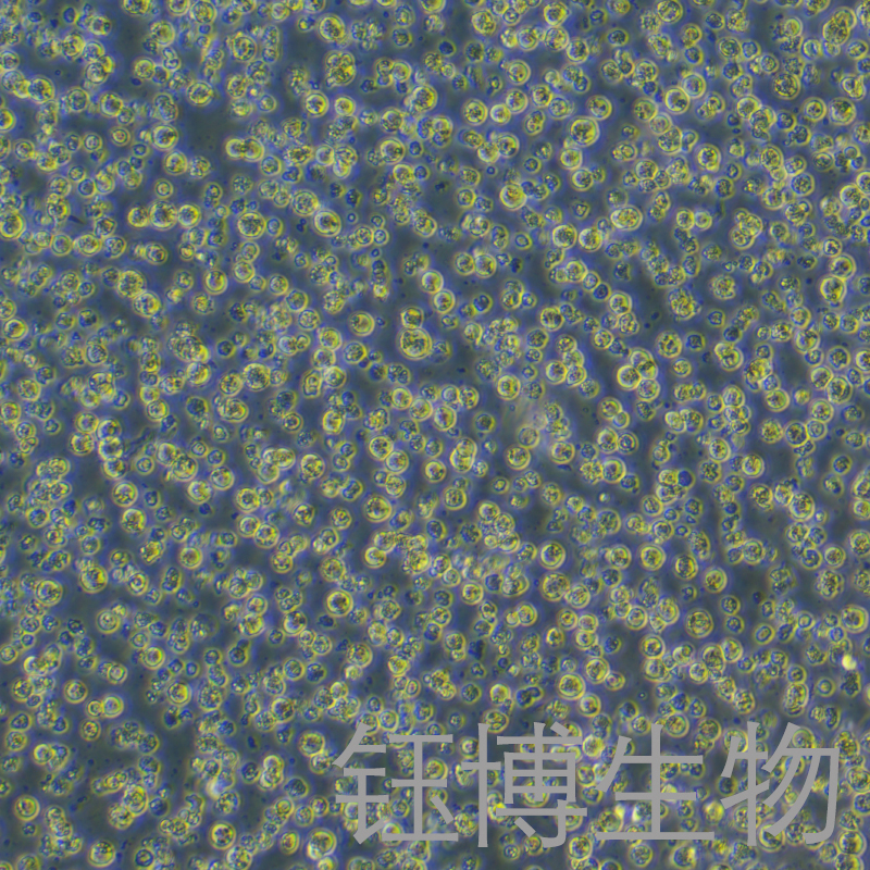 AKATA（EBV转化淋巴细胞系）YB-71884HC