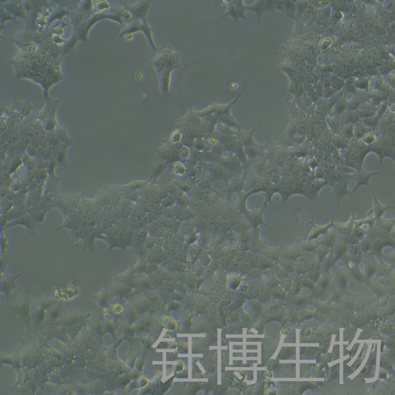 KYSE-140（人食管鳞状细胞癌）YB-71893HC