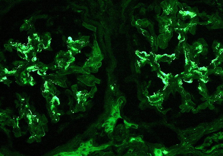 小鼠肾小管上皮细胞