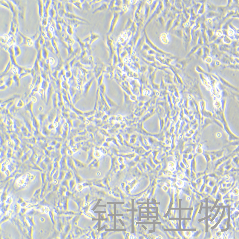 CTX-TNA2（大鼠脑星形胶质细胞）YB-7011RC
