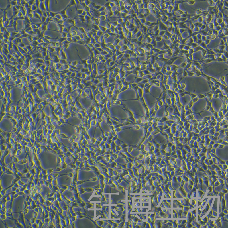 NRK-49F（大鼠肾细胞正常）YB-7014RC