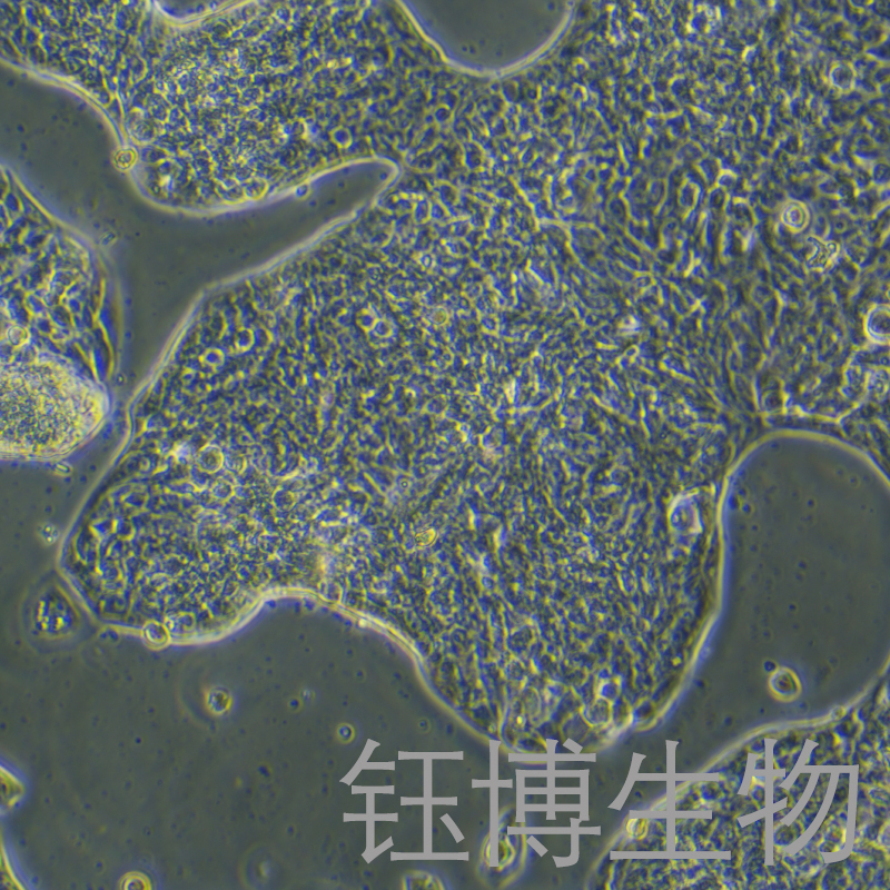 LC-2/AD（人肺癌腺癌细胞）YB-71910HC