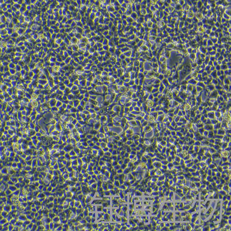 Plat-E（人逆转录病毒包装细胞 293亚型）YB-71913HC