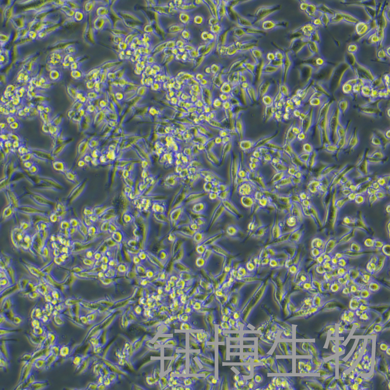 MC38-OVA（小鼠结肠癌细胞/大鼠结肠癌-OVA 鸡基因修饰）YB-7064MC