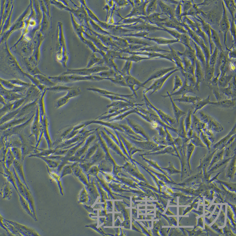 U251 MG/TMZ（人类星形胶质瘤耐替莫唑胺细胞）YB-71940HC