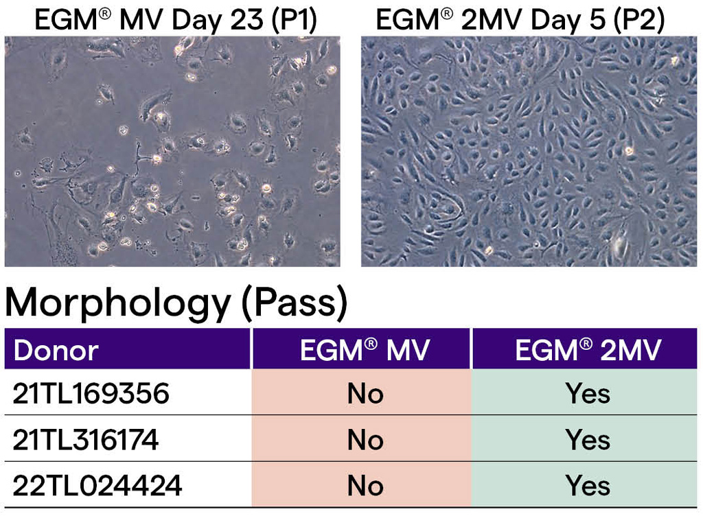 EGM-2-MV 内皮细胞培养基套装（CC-3156 & CC-4147）