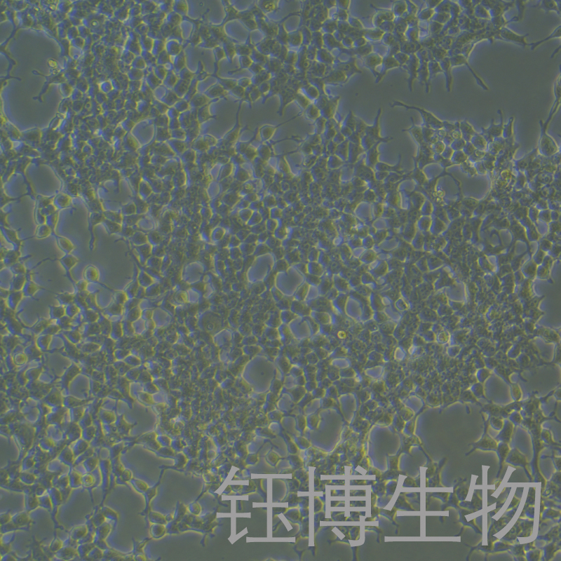 Phoenix-ECO（人逆转录病毒包装细胞系）YB-71955HC