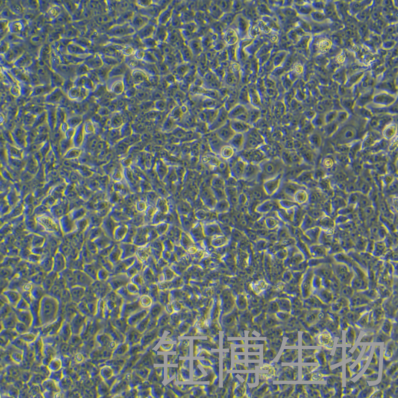 KYSE-450（人食管鳞癌细胞）YB-71956HC